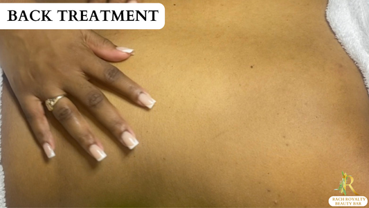Taming the Back Acne Beast: A Guide to Clearing Up Your Back