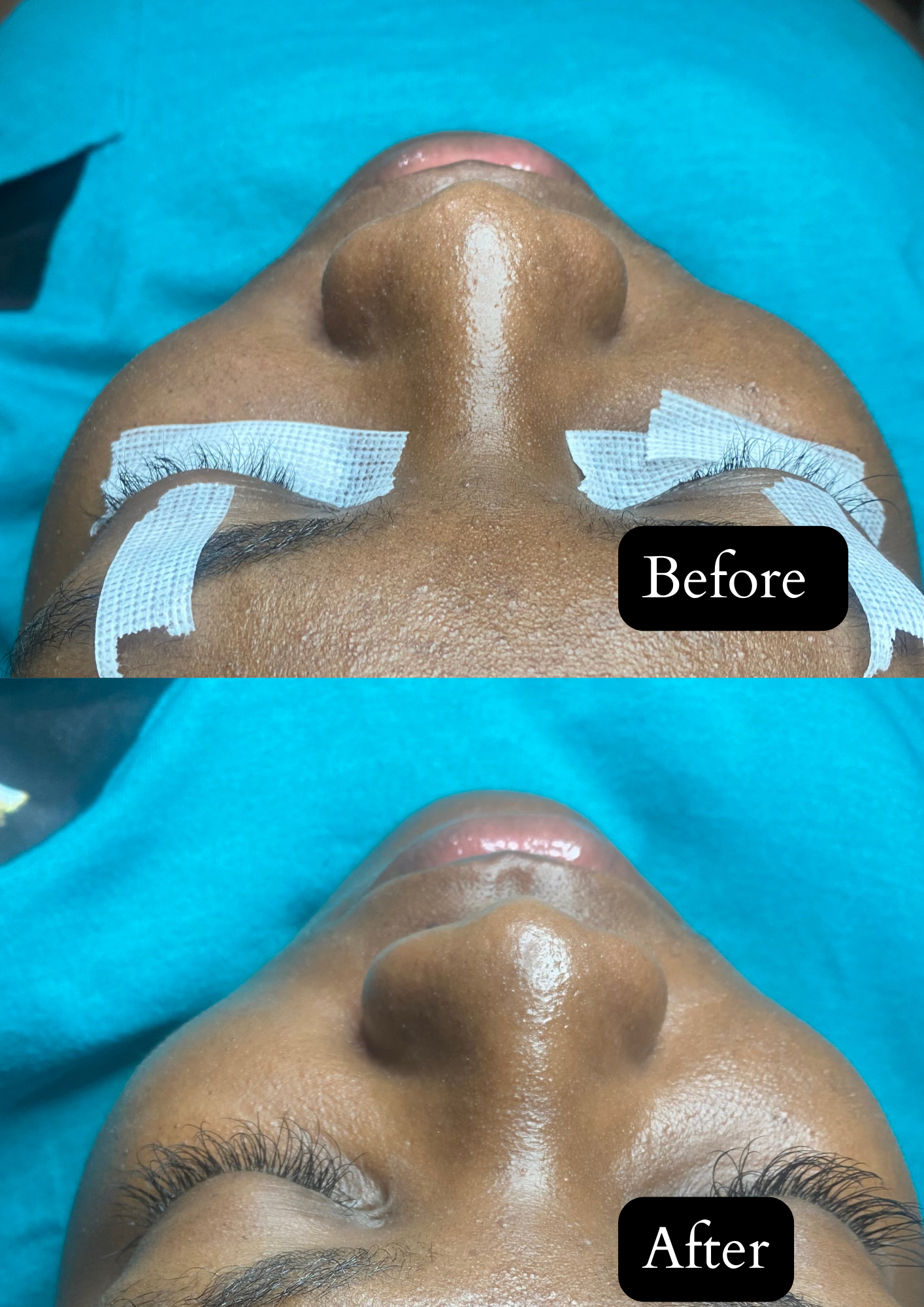 Eyelash Extensions