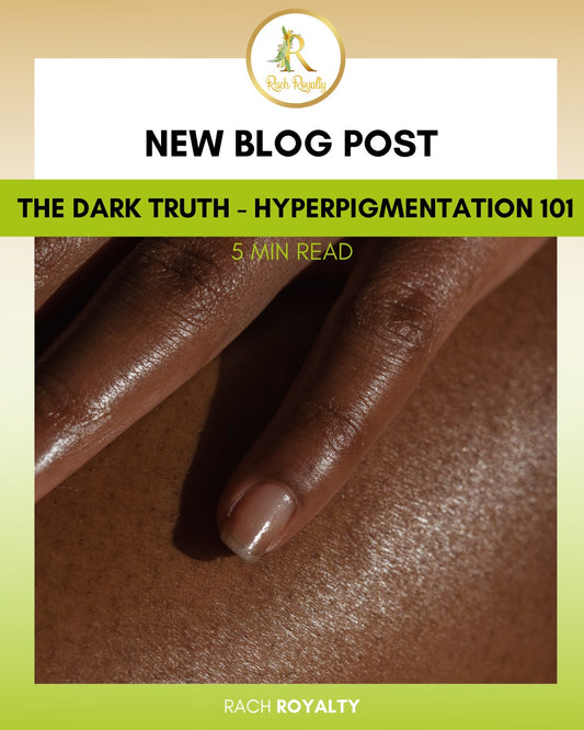The Dark Truth - Hyperpigmentation 101